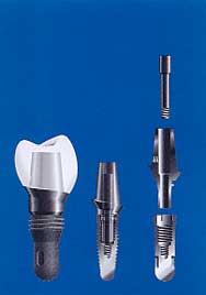 カムログシステム