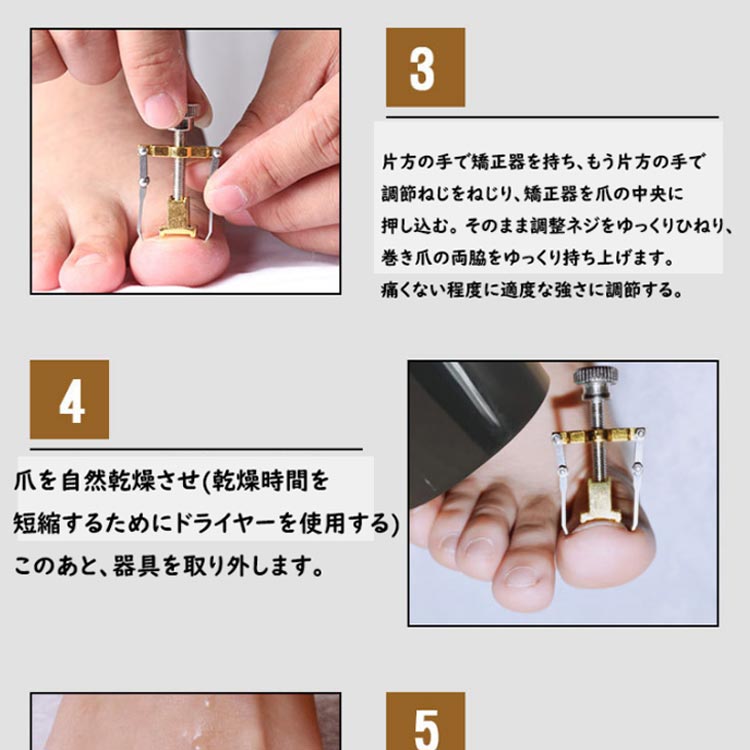 楽天市場】3個セット 巻き爪 矯正 サポート 器具 ネイルケア ツール