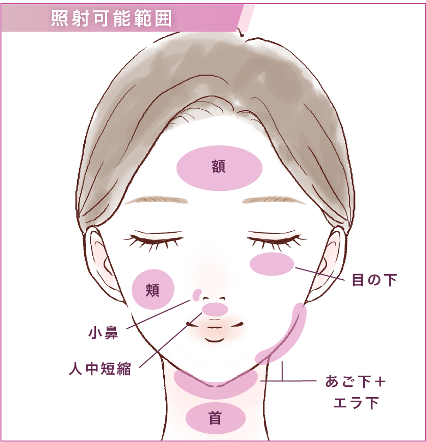 オリジオキッス（高周波+HIFU）｜美容整形・美容皮膚科｜ルラ（LULA