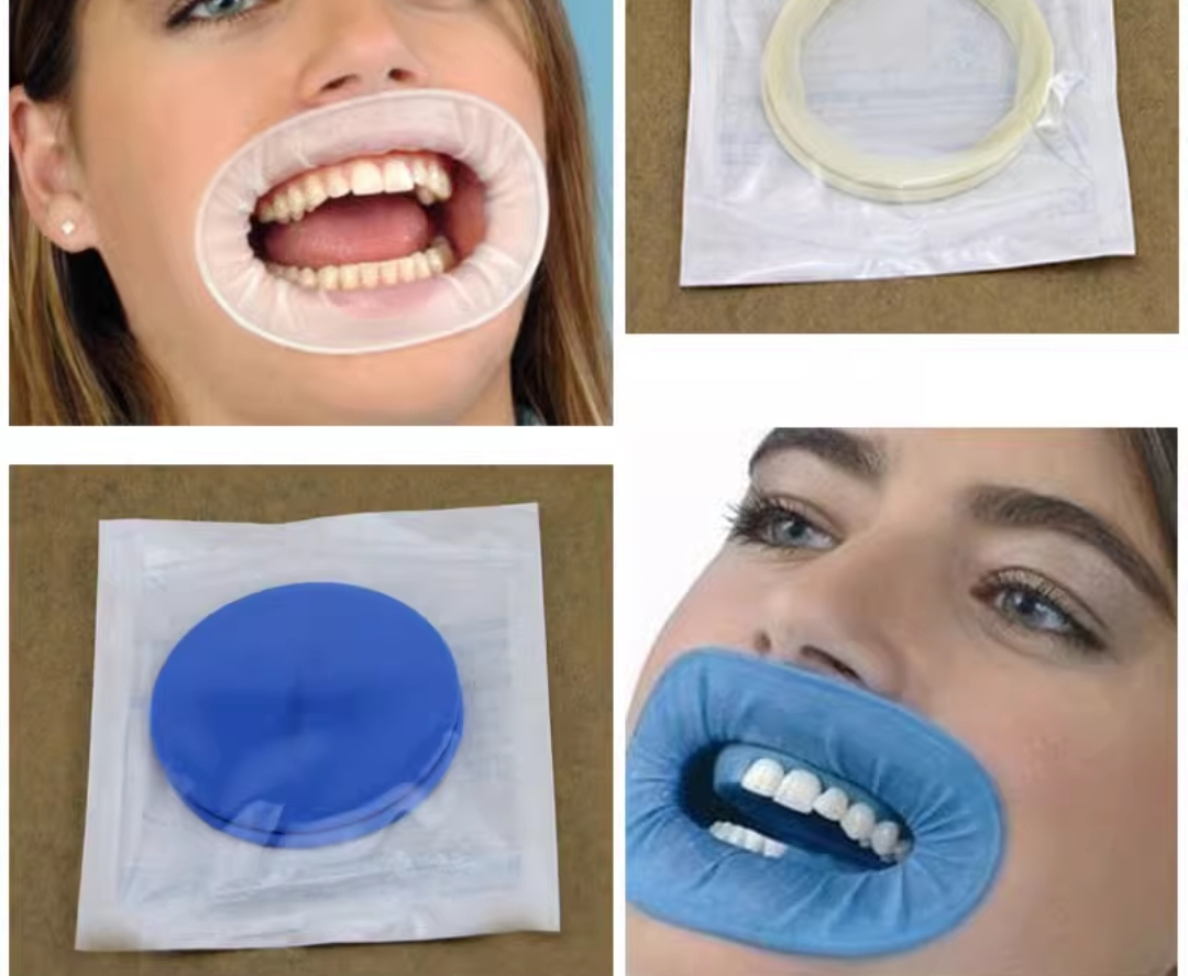 ラバーダムマウスオープナー・オーラルチークエキスパンダーリ