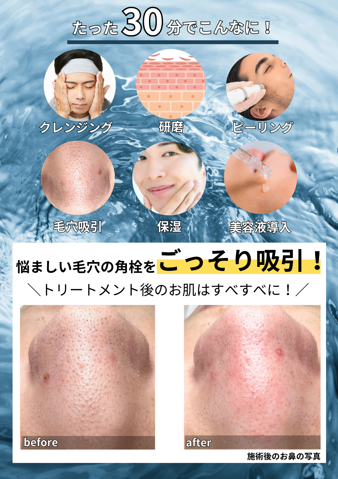 毛穴洗浄｜TODAY-滋賀県草津市の完全予約制メンズ脱毛サロン