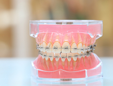 PBMヒーリングオルソ