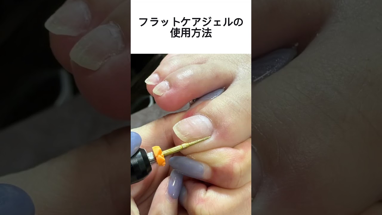巻き爪ジェル フラットケアジェル