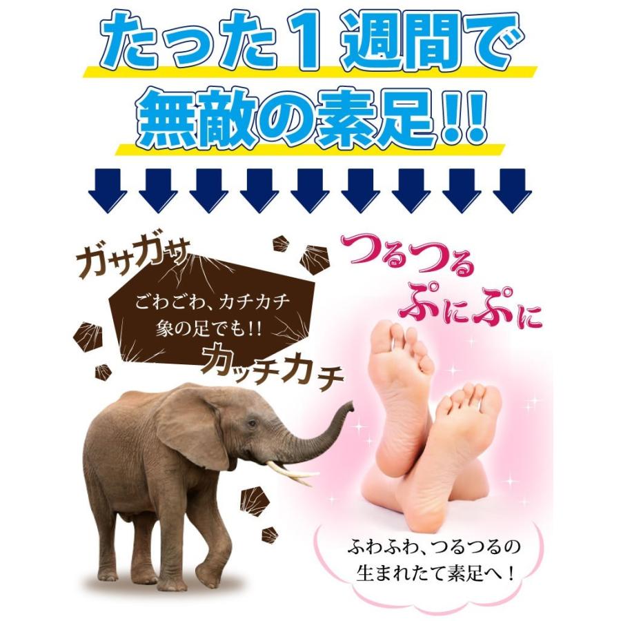ステイフリー かかと 角質除去 両足12回分 角質ケア フットケア
