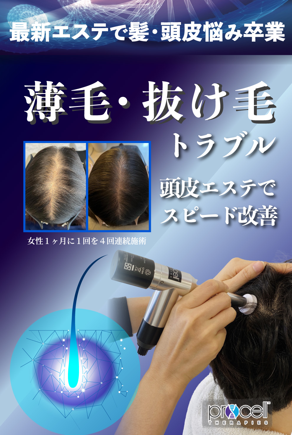 プロセルセラピーズ 頭皮用美容液 5ml×2本 2026年最新】プロセル