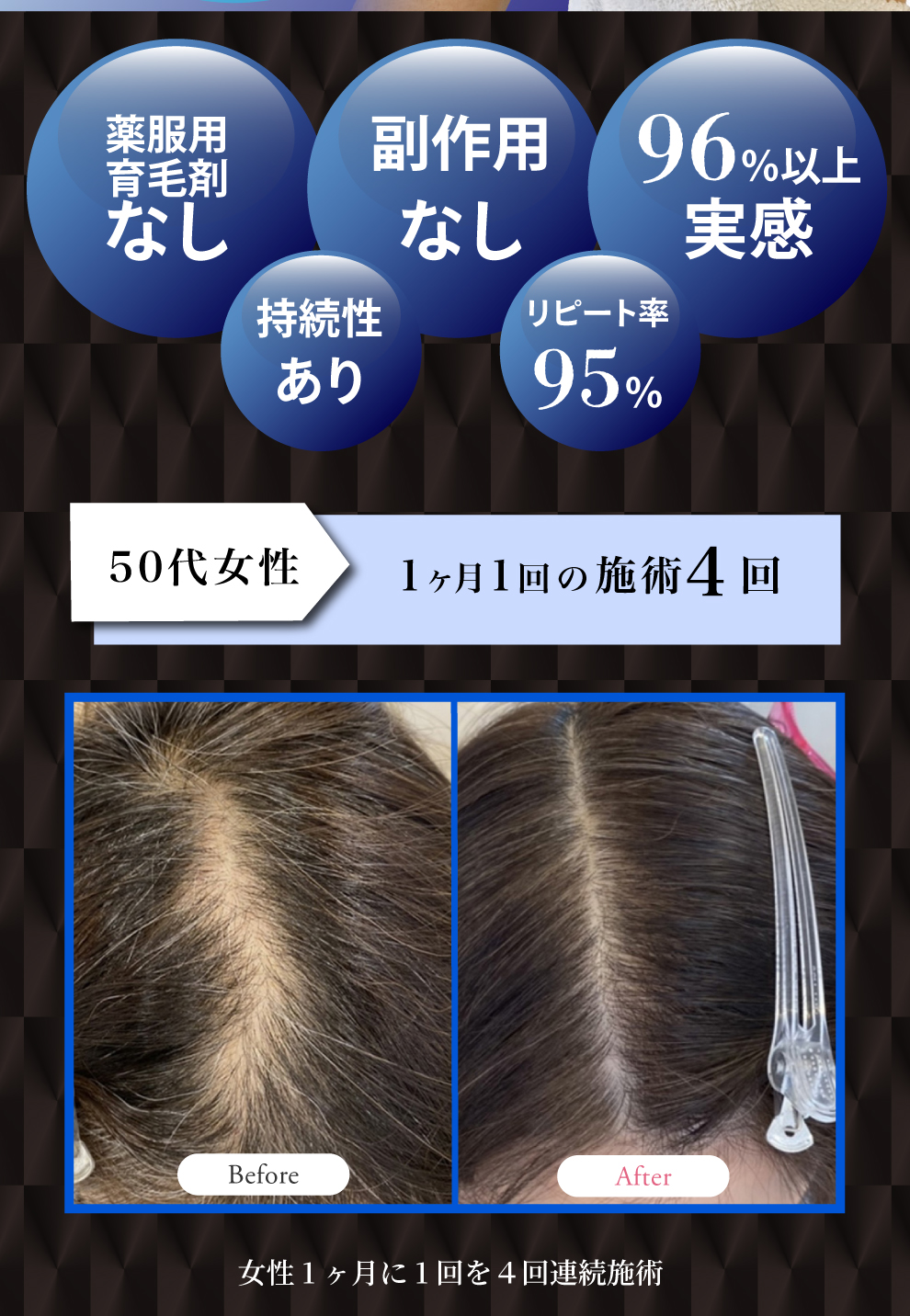 プロセルセラピーズ 頭皮をスピード改善し驚くほど元気にします